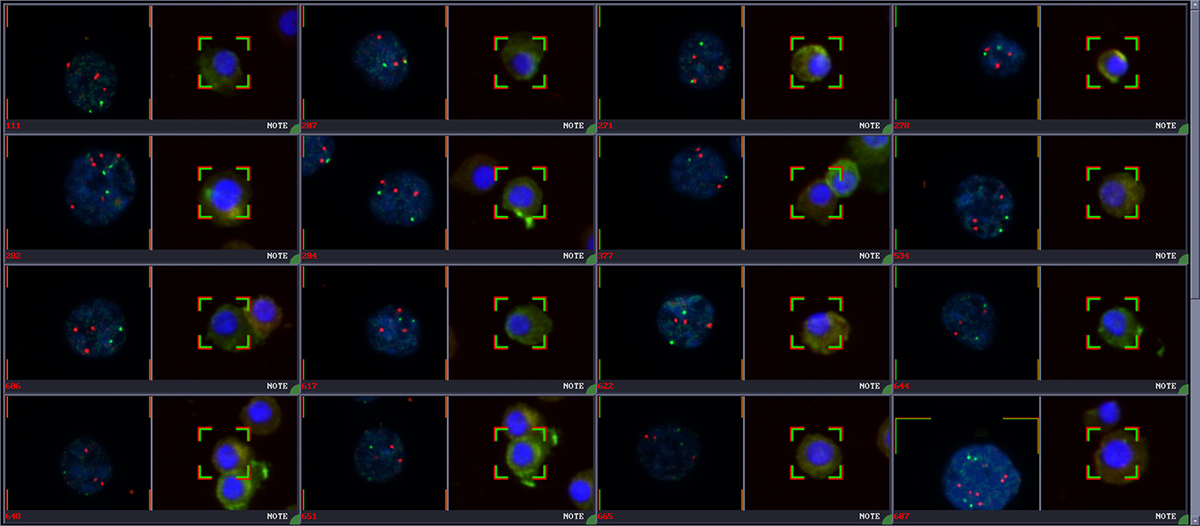 Circulating Tumor Cells