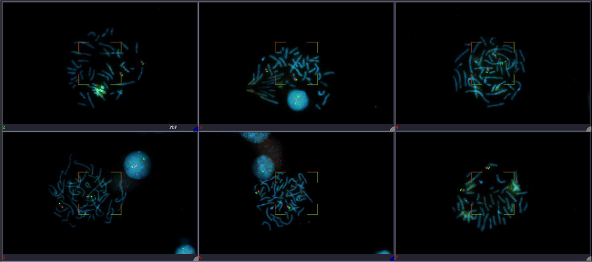 Fluorescent metaphase gallery