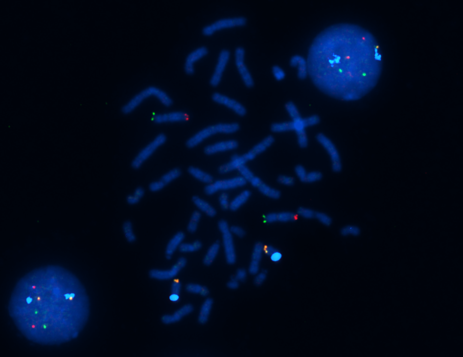 Fluorescent metaphase detail