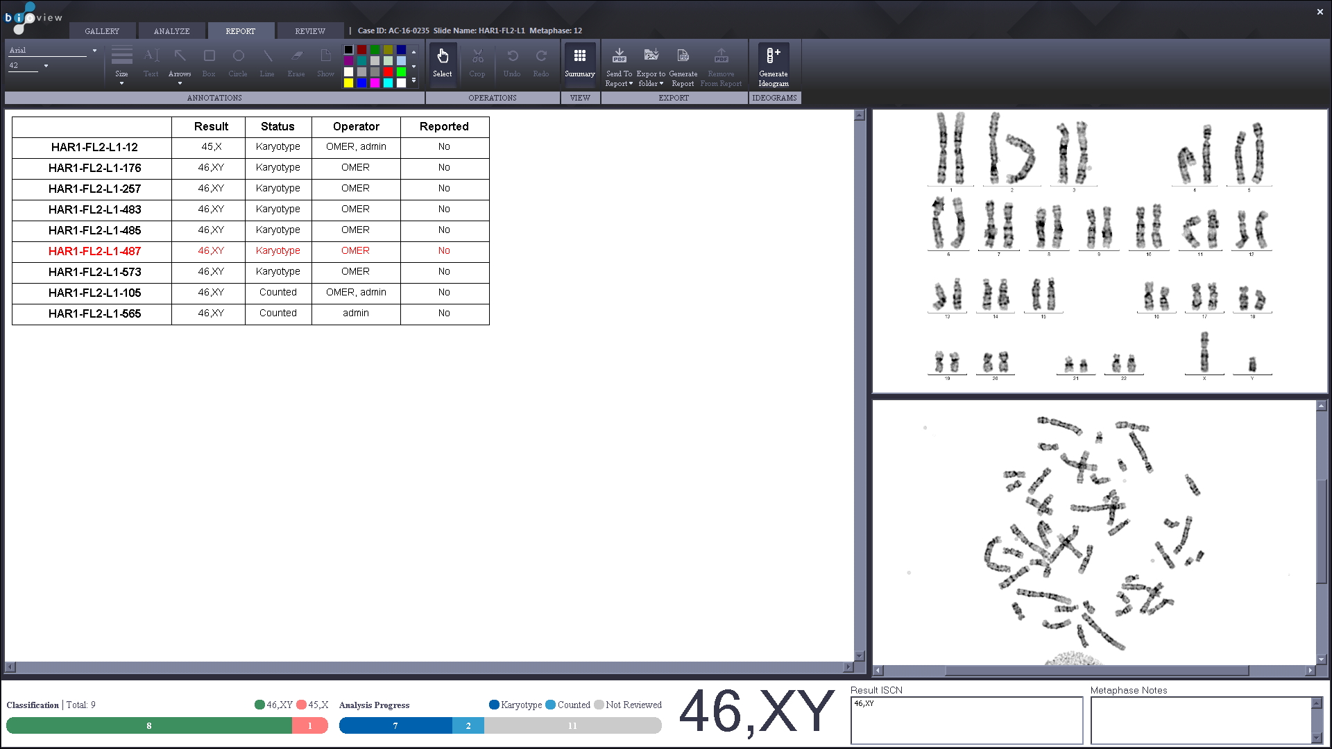 Karyotype