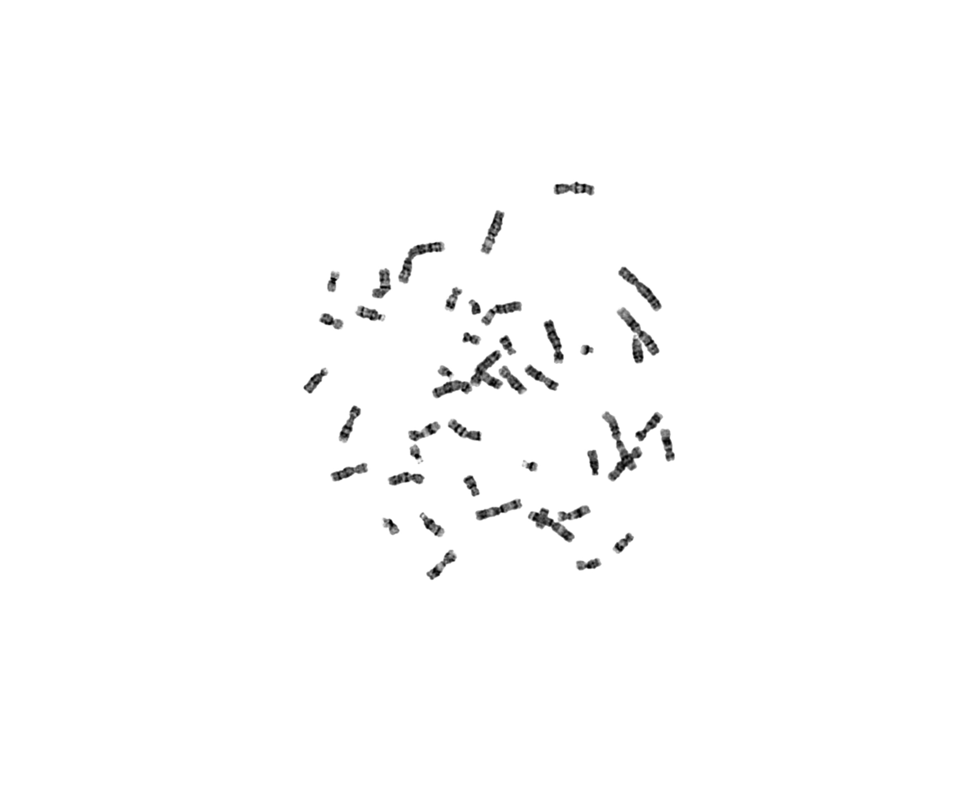 Metaphase spread