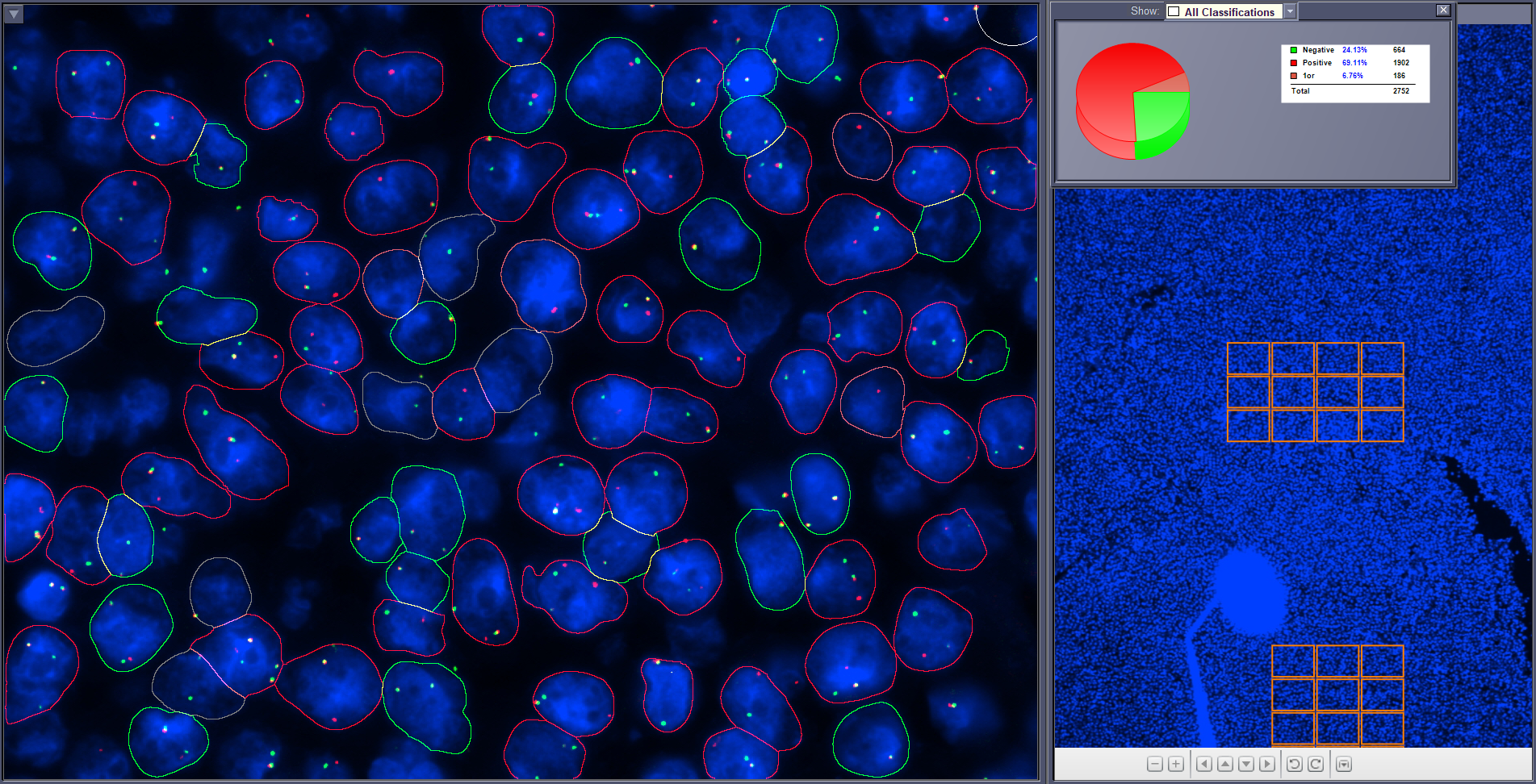 Per-channel fluorescence view used to check signal attribution during review